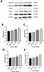GSK3B Antibody in Western Blot (WB)