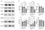Thrombospondin 1 Monoclonal Antibody (A6.1)