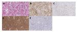 CD44 Antibody in Immunohistochemistry (IHC)