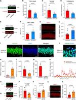 Acetyl-HMGB1 (Lys29) Antibody in Western Blot (WB)