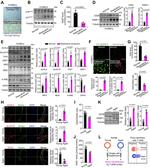 ALOX15 Antibody in Western Blot, Immunohistochemistry (WB, IHC)