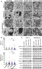 ITPR3 Antibody in Western Blot (WB)