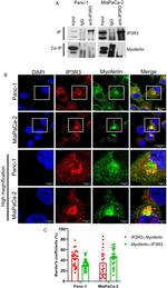 ITPR3 Antibody in Immunoprecipitation (IP)