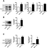 TNF alpha Antibody in Western Blot (WB)