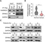 SPINK2 Antibody in Western Blot (WB)