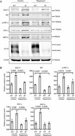 SGLT1 Antibody in Western Blot (WB)