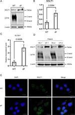 SGLT1 Antibody in Western Blot (WB)
