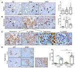 Renin Antibody in Immunohistochemistry (IHC)
