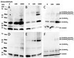 S100A9 Antibody in Western Blot (WB)