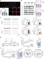 GluR4 Antibody in Western Blot (WB)