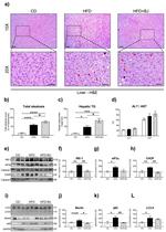 LC3A/LC3B Antibody in Western Blot (WB)