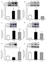 Calsequestrin Antibody in Western Blot (WB)