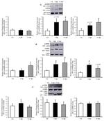 Calsequestrin Antibody in Western Blot (WB)
