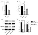 NFkB p65 Antibody in Western Blot (WB)