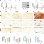 SLC7A11 Antibody in Western Blot, Immunohistochemistry (WB, IHC)
