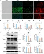SLC7A11 Antibody in Western Blot (WB)
