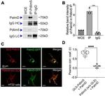 PDLIM5 Antibody in Western Blot (WB)