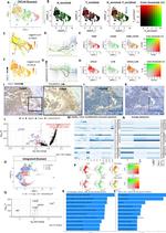 TXNIP Antibody in Immunohistochemistry (IHC)