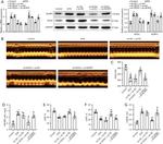 NOX4 Antibody in Western Blot (WB)