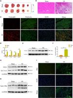 UBE2D3 Antibody in Western Blot (WB)