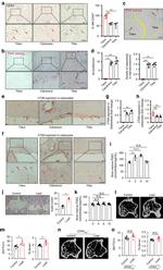 Cathepsin K Antibody in Immunohistochemistry (IHC)
