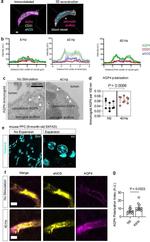 Aquaporin 4 Antibody in Immunohistochemistry (IHC)
