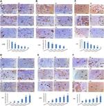 Caspase 3 Antibody in Immunohistochemistry (IHC)