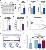 ASB2 Antibody in Western Blot (WB)