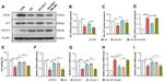 ACSL4 Antibody in Western Blot (WB)
