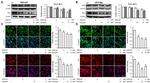 Estrogen Receptor alpha Antibody in Western Blot (WB)