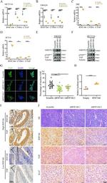 AMOTL2 Antibody in Western Blot (WB)