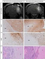 GFAP Antibody in Immunohistochemistry (IHC)