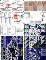 CD68 Antibody in Immunohistochemistry (IHC)