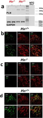 Phospholamban Antibody in Immunohistochemistry (IHC)
