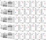CPT1B Antibody in Western Blot (WB)