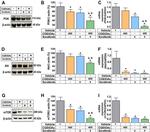AKT Pan Antibody in Western Blot (WB)