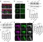 beta-3 Tubulin Antibody in Western Blot (WB)