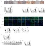RANK Antibody in Western Blot (WB)