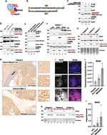 BAG2 Antibody in Western Blot, Immunohistochemistry, Immunoprecipitation (WB, IHC, IP)