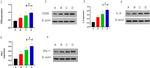 IFN gamma Antibody in Western Blot (WB)