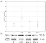 ROCK1 Antibody in Western Blot (WB)