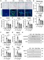 TIMP1 Antibody in Western Blot (WB)