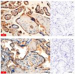 FABP4 Antibody in Immunohistochemistry (IHC)
