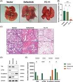 FAK Antibody in Western Blot (WB)