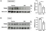 TREM2 Antibody in Western Blot (WB)