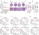 ACSS2 Antibody in Immunohistochemistry (IHC)
