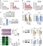ACSS2 Antibody in Western Blot (WB)