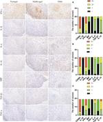 IFN gamma Antibody in Immunohistochemistry (IHC)