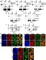 DDX17 Antibody in Western Blot, Immunoprecipitation (WB, IP)
