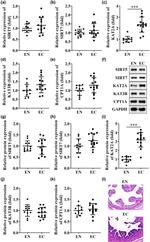 SIRT7 Antibody in Western Blot (WB)
